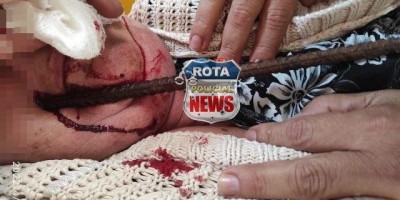 Idosa tem vergalhão “fincado” no rosto após sofrer queda na rua em Vilhena