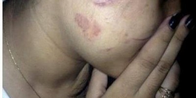Garota é agredida e mantida em cárcere privado pelo marido em apartamento