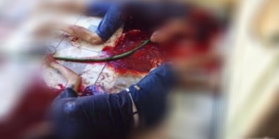 Um homem é morto e duas pessoas ficam feridas após ataque a tiros em Urupá
