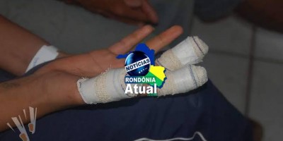 Ji-Paraná: Aluno vai jogar bomba na sala e ela explode em sua na mão
