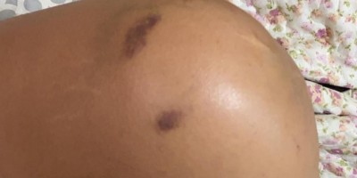 Mulher é espancada pelo amigo de infância ao reagir estupro