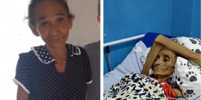 Sem documentos, idosa não consegue tratamento para câncer e família pede ajuda em RO:...
