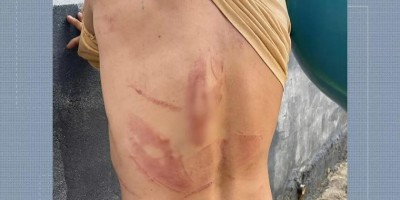 Casal é brutalmente espancado a facãozadas em Ji-Paraná