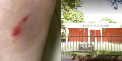 Tapas, chutes e cusparadas: demora no atendimento vira briga entre pacientes e...