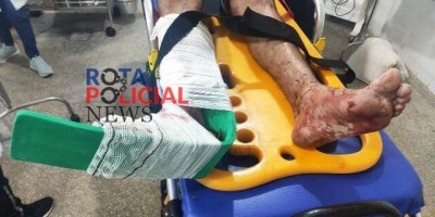 Motociclista embriagado sofre laceração no pé após acidente em Vilhena