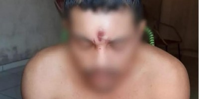 Homem leva tiro na testa, cai de moto e vai para casa dormir; Acredite: isso aconteceu no...