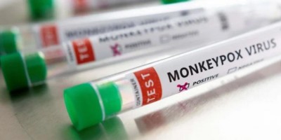 Varíola dos macacos: Casos suspeitos de RO são agricultores que moram na zona rural de...