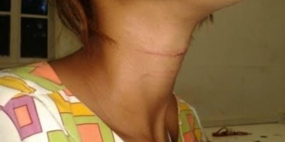 Marido é preso por agredir e ameaçar matar esposa com facada no pescoço