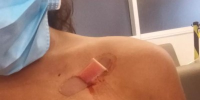 Empregada doméstica é vítima de tentativa de homicídio em Machadinho