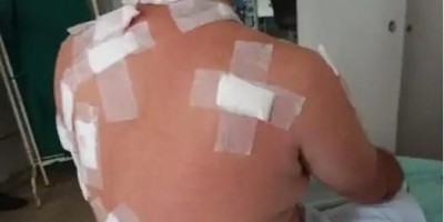 Ji-Paraná: Homem sobrevive após ser atacado com mais de 20 facadas
