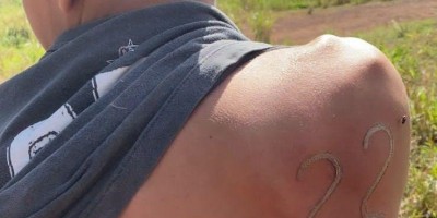 Vida de gado: Com ferro em brasa, garoto de 17 anos tatua '22' nas costas