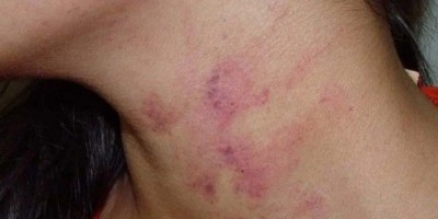 PM prende homem que fez mulher perder o bebê após espancá-la