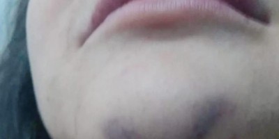 Mãe é agredida com socos no rosto pelo filho por causa de certidão de nascimento