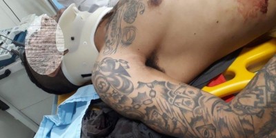 Assaltantes atrapalhados atiram na perna da vítima e durante a fuga se envolvem em grave...