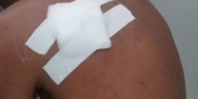 Por ciúmes, jovem é esfaqueado nas costas pela esposa após chegar em casa