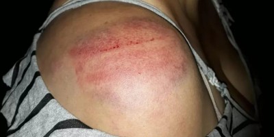 Mulher é agredida na cama por não deixar o marido ler mensagens no WhatsApp