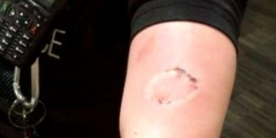Mulher é acusada de atacar vizinhos a tesourada e morder policiais militares