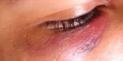 Ji-Paraná: Mulher é agredida pelo namorado até desmaiar três vezes, mas se recusa a...