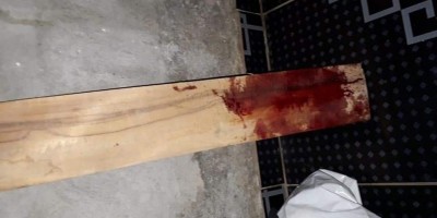 Mulher é agredida pelo namorado com pauladas na cabeça em Ji-Paraná