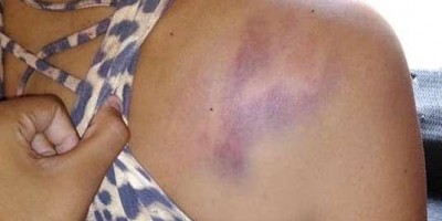 Mulher é agredida pelo marido ao chegar em casa de madrugada