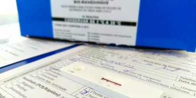 Rolim de Moura: Casos de covid-19 apresentam tendência de queda após dois meses em alta