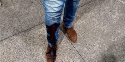 Tiroteio em lavador deixa uma pessoa ferida em Ji-Paraná