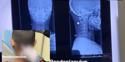 Motociclista é atingido na nuca por bala perdida em Porto Velho