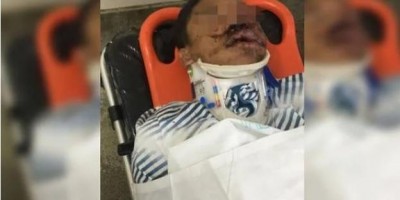 Jovem é internado na UTI após ser espancado em fim de festa