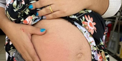 Sogra entra na briga de casal e espanca a nora grávida