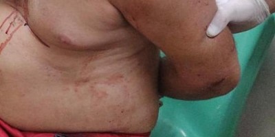 Homem 'ouve vozes' e dá facadas na esposa e na sogra