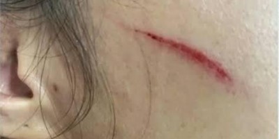 Filha é presa por agredir a mãe com socos e pauladas