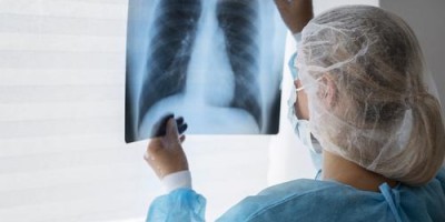 24 de março: Dia Mundial de Combate à Tuberculose 