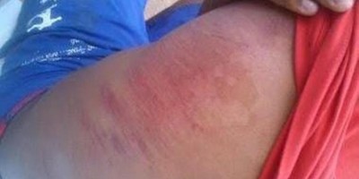 Garoto de 14 anos é espancado por bandidos durante assalto