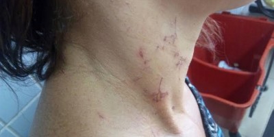 Dona de casa é acordada com socos pelo marido embriagado