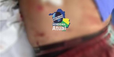 Homem é atacado a facadas após discussão em Ji-Paraná