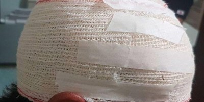 Genro ataca o sogro após brigar com a esposa