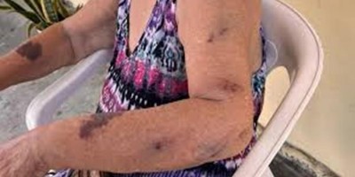 Idoso agride esposa a vassourada para não pagar dívida