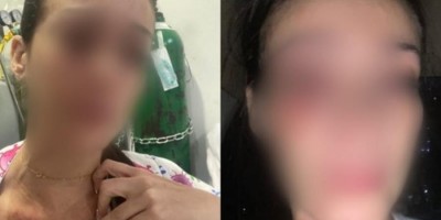 Enfermeira é agredida por mãe de paciente em hospital