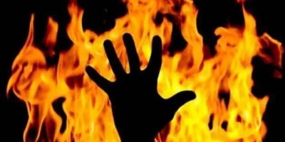 Cacoal: Mulher morre no hospital após ter corpo queimado; Marido teria jogado álcool e...
