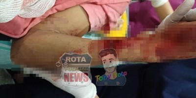 Jovem é atacado com golpes de facão em Vilhena