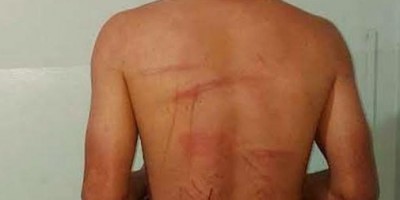 Mulher chama amigas e homem acaba agredido a mangueirada