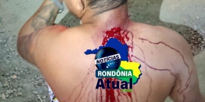 Ex-mulher esfaqueia homem no pescoço em Ji-Paraná