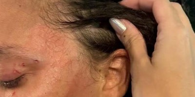 Mulher é agredida ao expulsar marido bêbado de casa