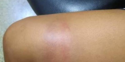 Mulher passa a madrugada sendo espancada pelo marido
