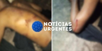Homem em situação de rua é esfaqueado após briga no centro