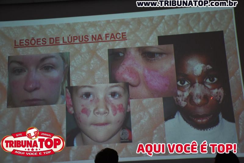 ROLIM DE MOURA: PALESTRA FSP