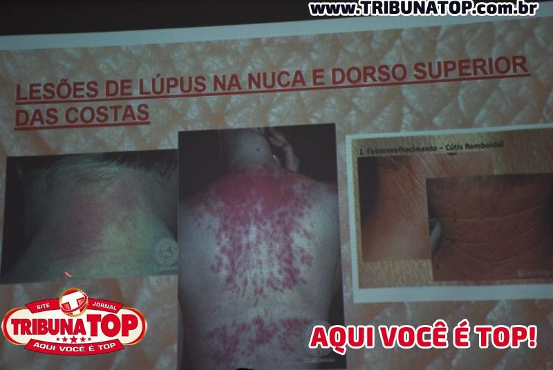 ROLIM DE MOURA: PALESTRA FSP