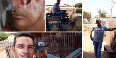 ROLIM DE MOURA: Filho conta história do pai que perdeu um olho vítima de câncer e pede...