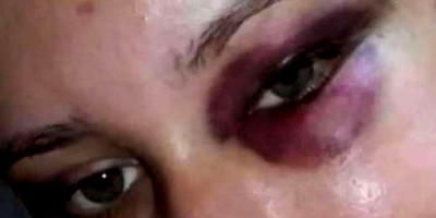 Mulher recusa ir beber com o namorado e é espancada em Porto Velho Mulher recusa ir beber com o namorado e é espancada em Porto Velho