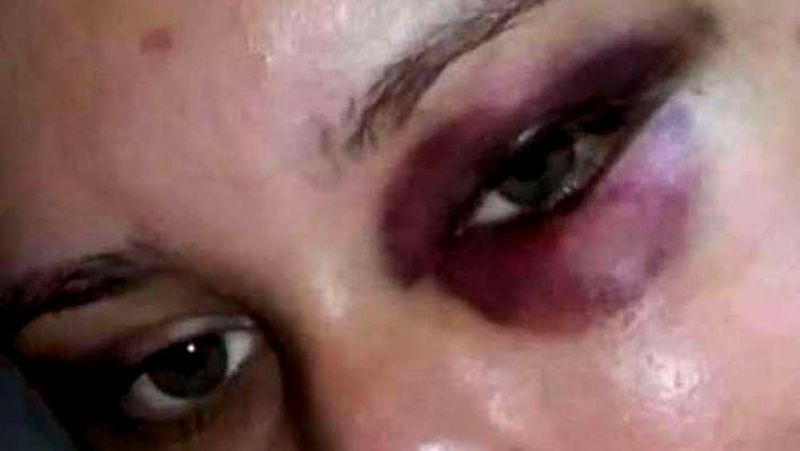 Mulher recusa ir beber com o namorado e é espancada em Porto Velho Mulher recusa ir beber com o namorado e é espancada em Porto Velho